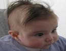 علت ریزش موی کودک چیست؟