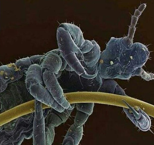 عکس/ شپش چسبیده شده به موی سر انسان در زیر میکروسکوپ 