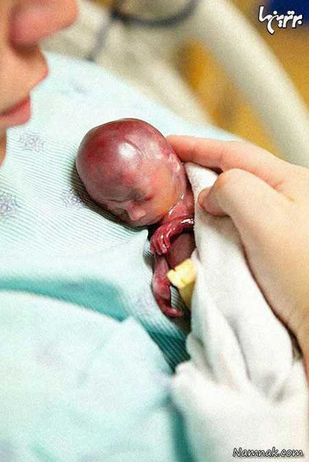 به دنیا آمدن جنین ، به دنیا آمدن جنین ، تولد جنین شش ماهه