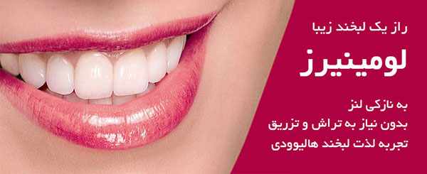 راز یک لبخند زیبا - دندانپزشک زیبایی - دکتر علیرضا میرزایی