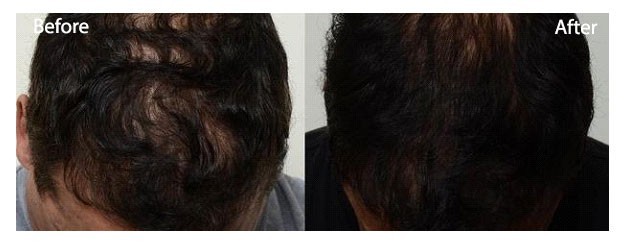 لیزر مو زائد و هایفوتراپی و لیفت صورت با نخ، PRP، درمان ریزش مو و سابسیژن، جراحی پلک و لیفت ابرو