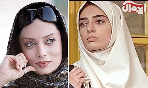 بازیگران ایرانی، قبل از عمل و بعد از عمل