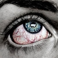 دکتر سلام/ رایج ترین علل قرمزی چشم