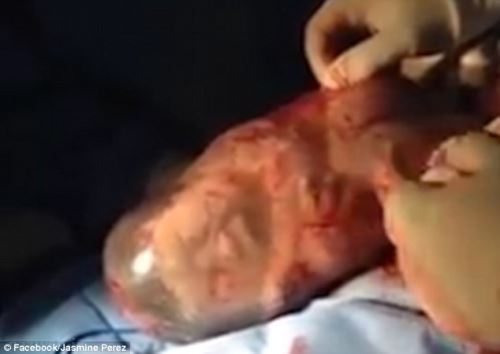 نوزادی که با تولد حیرت انگیز پزشکان را به چالش کشید! عکس