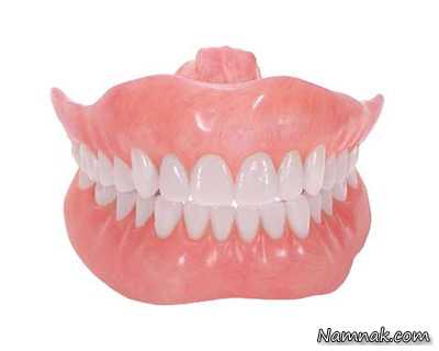 پروتز دندان ، دندان مصنوعی ، پروتز دندان،انواع پروتز دندان