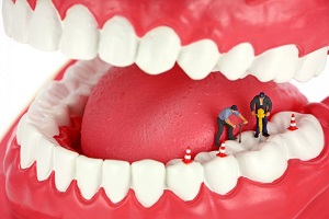 دهان و دندان/ چرا دندان عصب‌کشی شده هنوز درد دارد؟