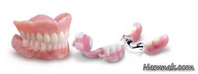 پروتز دندان ، پروتز متحرک دندان ، پروتز کامل دندان