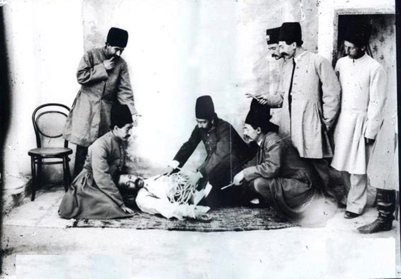 کشیدن دندان با گازانبر در دوره قاجار