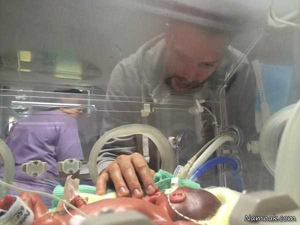 تولد نوزاد نارس ، مراقبت از نوزاد تازه متولد شده ، مراقبت از نوزاد نارس