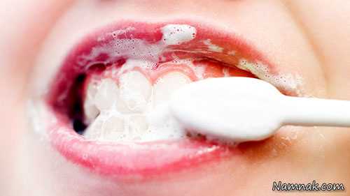 سفید کردن دندان ، جرم گیری دندان در خانه ، سفید شدن سریع دندان