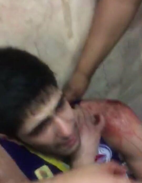 عکس/ حمله با سلاح سرد به بازیکن ملی‌پوش بسکتبال