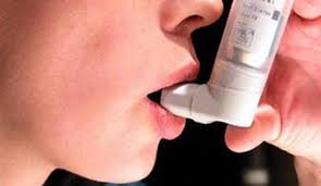 روش جدید برای درمان آسم و آلرژی