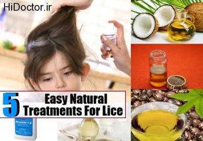 Treatments-For-Lice