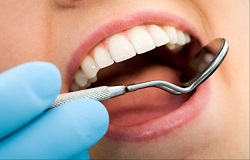 دهان و دندان/ سنگ فرشی که سلامت دهان را تهدید می‌کند 