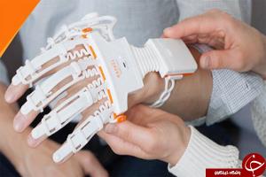 گوناگون/ طراحی دستکش هوشمند برای توانبخشی بیماران
