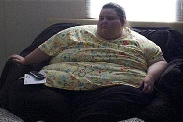 وضعیت چاق ترین دختر دنیا بعداز کاهش وزن