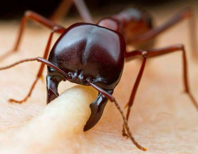 عکس/ لحظه ای که مورچه انسان را گاز می گیرد!!