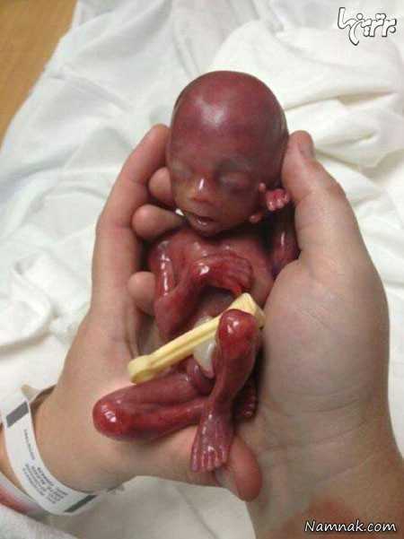 به دنیا آمدن جنین ، جنین 19 هفته ای ، عکس جنین شش ماهه