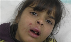 خبرگزاری فارس: ضرب و شتم دختربچه فلسطینی به دست یک شهرک‌نشین +تصاویر