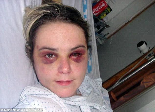 حوادث/ ضرب و شتم وحشیانه زن توریست پس از ساعت‌ها تعرض در مراکش 
