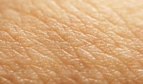 پوست و مو/ نکاتی برای پیشگیری از شایع‌ترین نوع قارچ پوستی