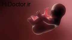 مامان و نی نی/ آسیب های مختلف جنین در بارداری
