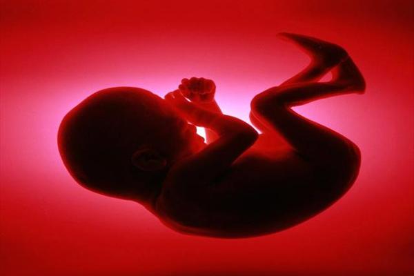 بارداری/ یک چهارم بارداری ها سقط می شوند