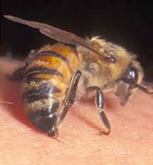 دکتر سلام/ در زنبور گزیدگی چه موقع باید به دنبال مراقبت های پزشکی بود؟
