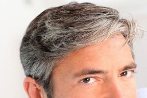 پوست و مو/ دلیل سفید شدن مو در سن جوانی چیست؟