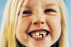 کودک/ حفظ دندان‌های شیری برای داشتن دندان های زیبا در آینده فرزندتان, یک ضرورت است!!