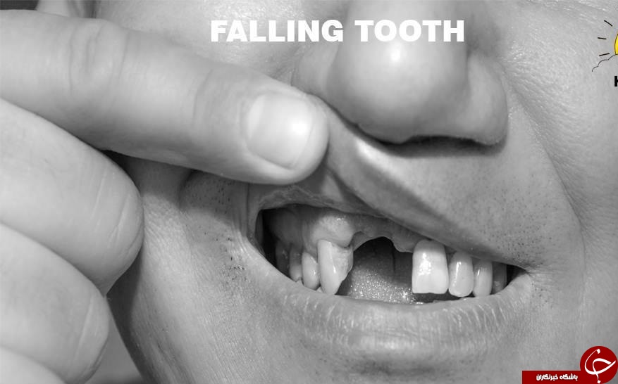 رایج ترین کابوس های شبانه/ از افتادن دندان تا سقوط از بلندی در خواب+ تصاویر