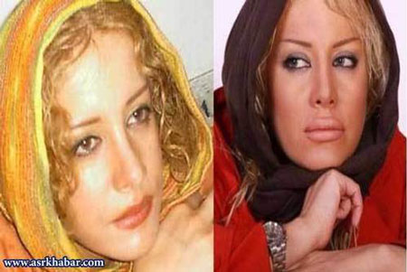 عکس: بازیگران زن ایرانی، قبل و بعد از عمل