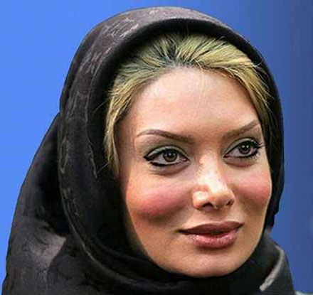 معروف شدن بازیگران ایرانی با جراحی زیبایی