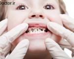افزایش سلامت دهان و دندان خردسالان
