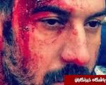 علی انصاریان غرق در خون ! +عکس