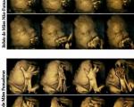 عکس/ تصویری ناراحت کننده از اثرات سیگار بر جنین