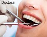 روش های استفاده از دندان مصنوعی