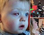 کور شدن چشم کودک با هدیه تولد! + تصاویر