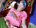 عکس/ شهادت کودک خردسال در حمله شیمیایی داعش