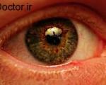 معاینات چشم پزشکی در چه زمانی باید انجام گردد؟