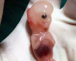 تصویری از جنین سقط شده