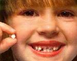 کودک/ سلامت دندان دائمی کودک در گرو سلامت دندان شیری