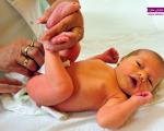 راه های درمان زردی نوزادان + علت، علائم و راه های تشخیص آن -آکا