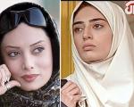 بازیگران ایرانی، قبل از عمل و بعد از عمل