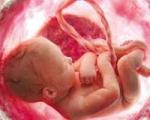 بارداری/ دختر یا پسر بودن نوزاد را خودتان تعیین کنید