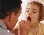 کودک/ گلودرد در کودکان و مصرف خودسرانه استامینوفن