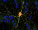 روش تازه‌ی دانشمندان برای تزریق سلول‌های عصبی سالم به مغزهای آسیب دیده