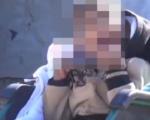 داعشی های شیطان صفت به شیوه نازی ها کودکان معلول را می کُشند + فیلم و تصاویر