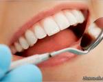 پر کردن دندان بدون نیاز به دندانپزشک