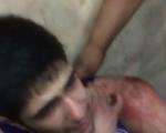 عکس/ حمله با سلاح سرد به بازیکن ملی‌پوش بسکتبال